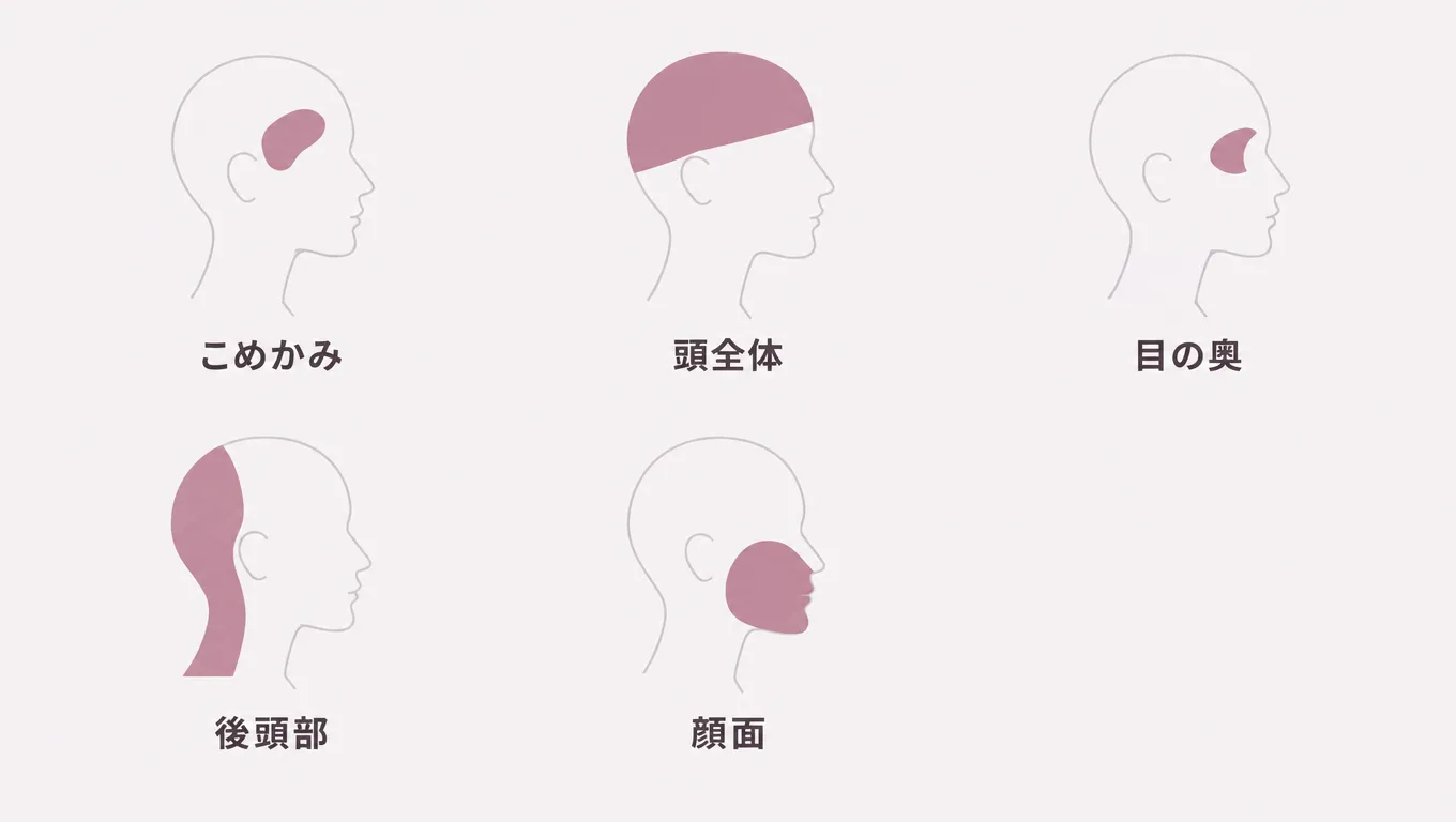 頭痛や顔の痛みを感じる場所を示す図